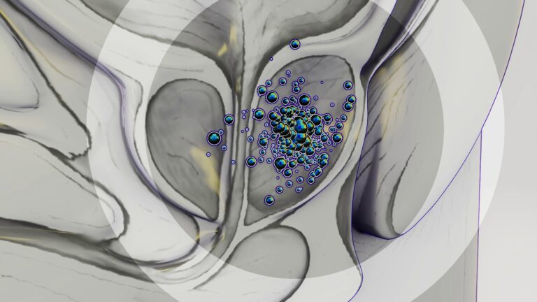 New Immunotherapy Drug Shows Remarkable Early Results in Advanced Prostate Cancer